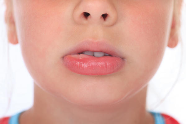 How To Get Rid of a Swollen Lip